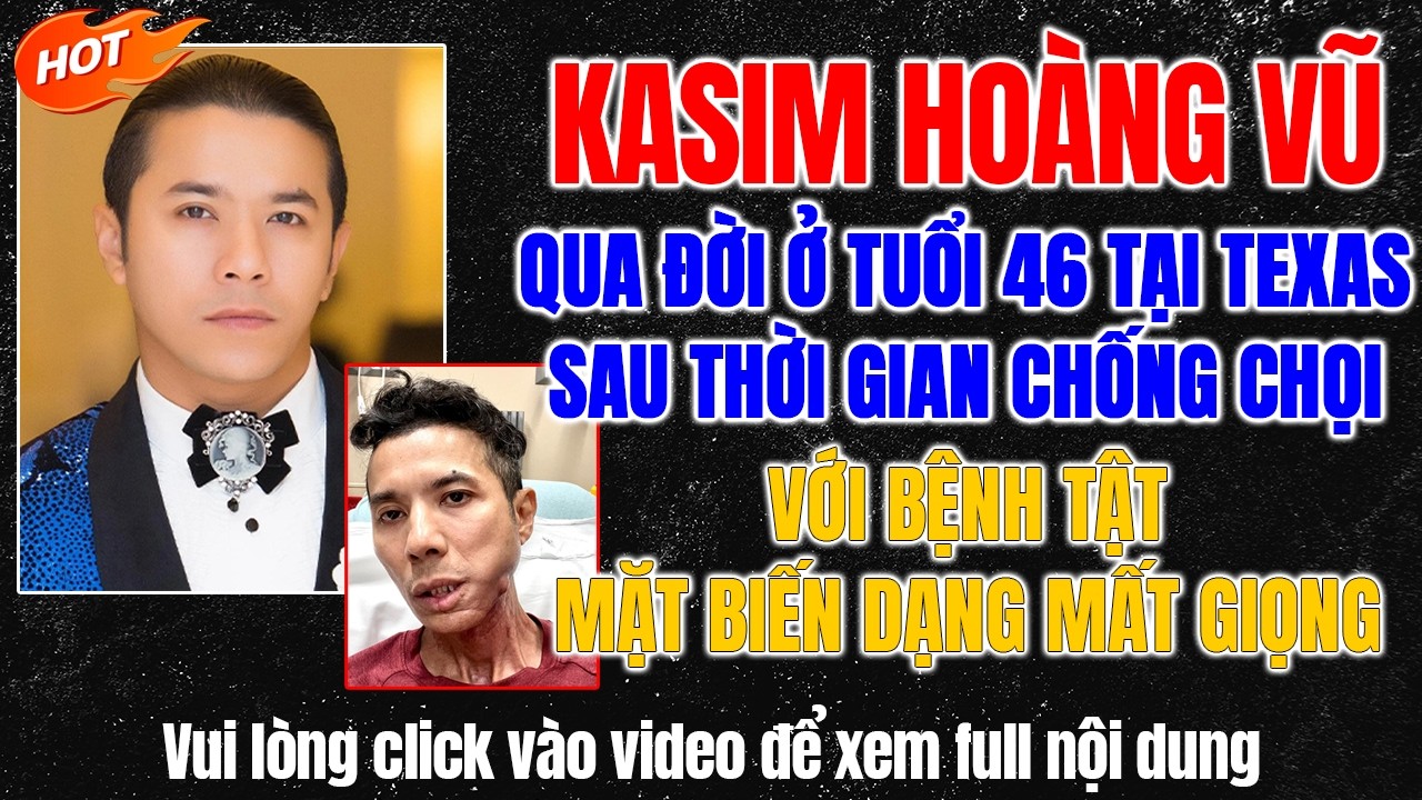 Kasim Hoàng Vũ: Tốn 15 Tỷ Chống Chọi Biến Chứng Nhỗ Răng Khôn 
