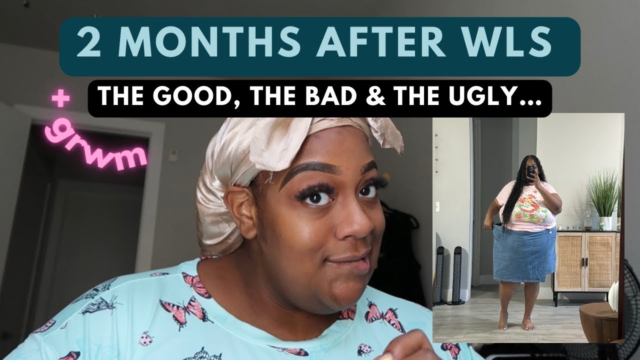Weight Loss Surgery: The Good, The Bad, & The Ugly…
