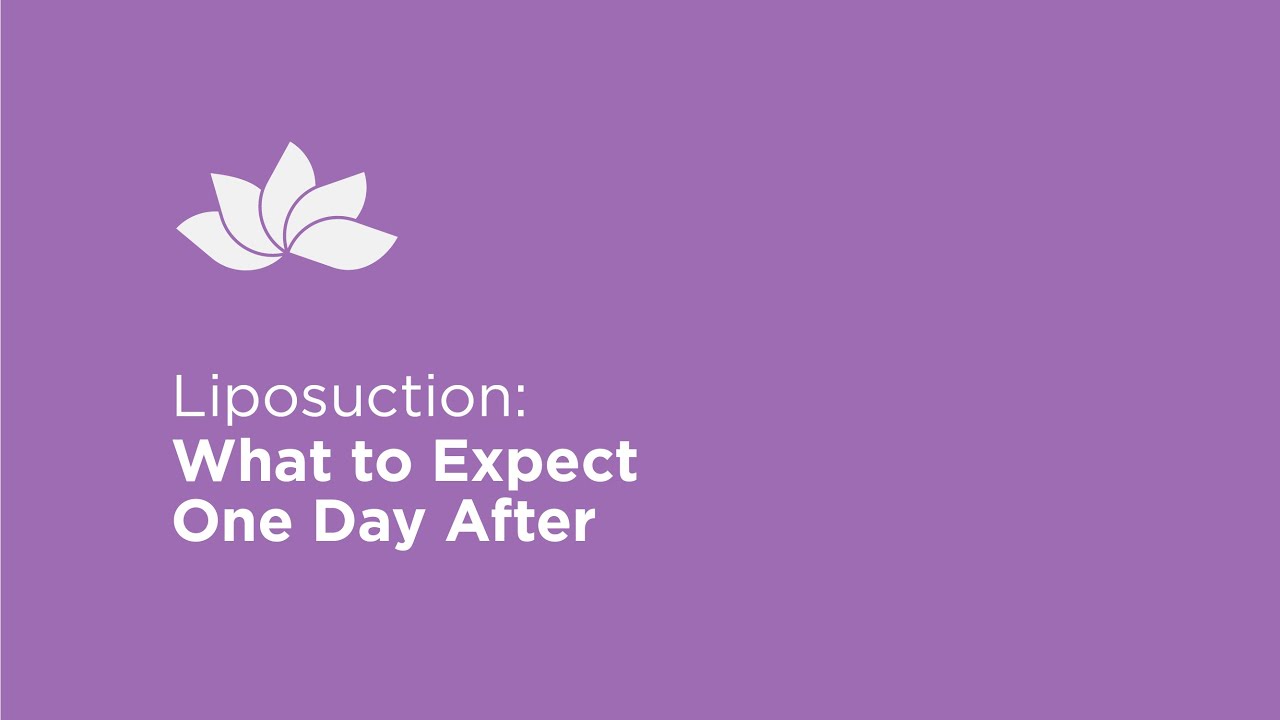 One Day After Liposuction - What To Expect | Plastic Surgeon Explains
