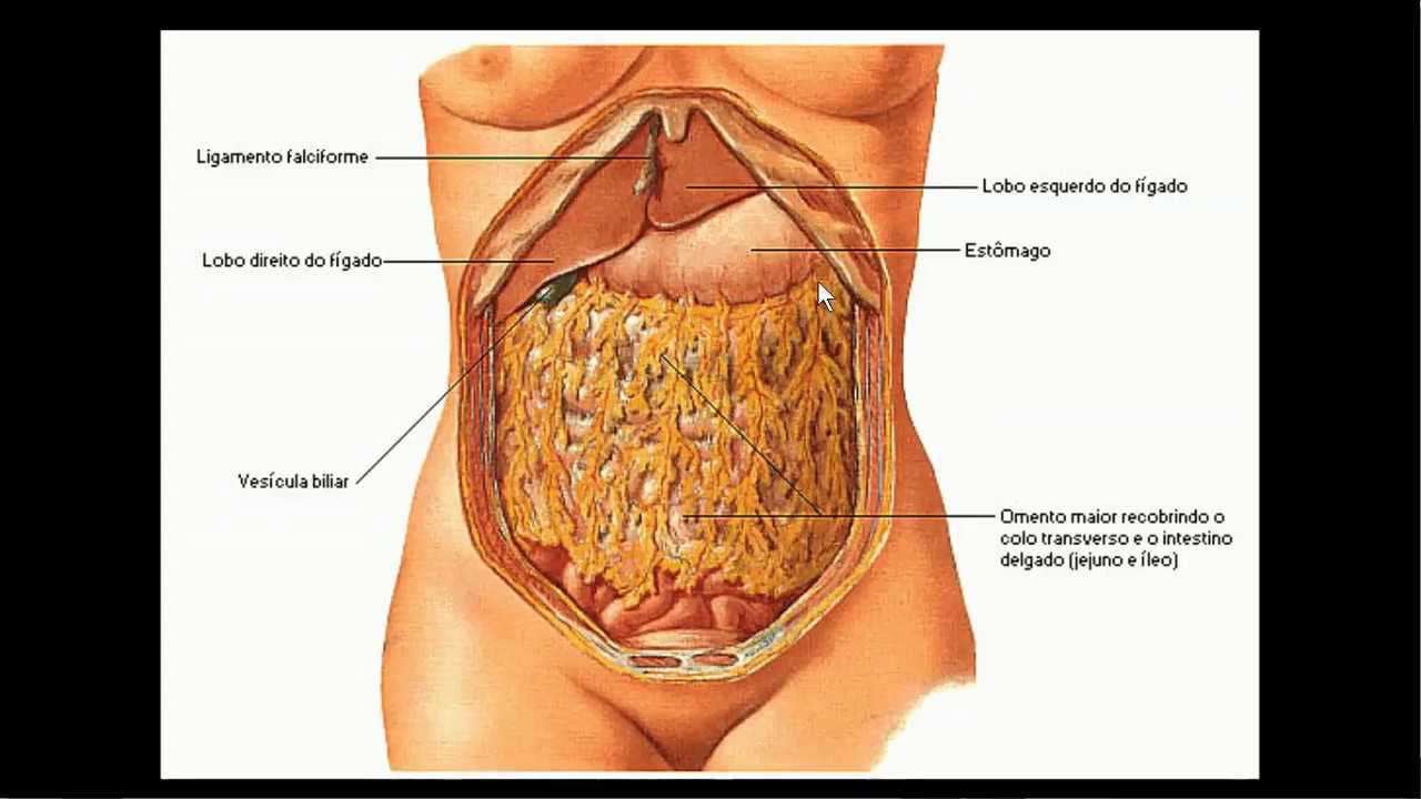 Carcinomatose peritoneal