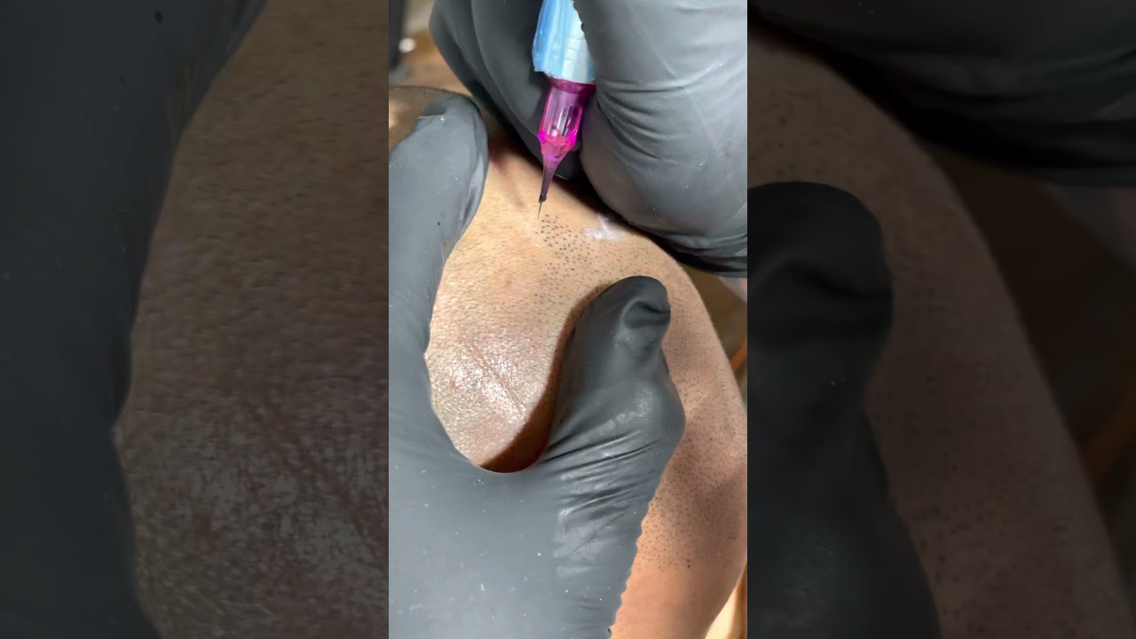 Does Scalp Micropigmentation look real ?