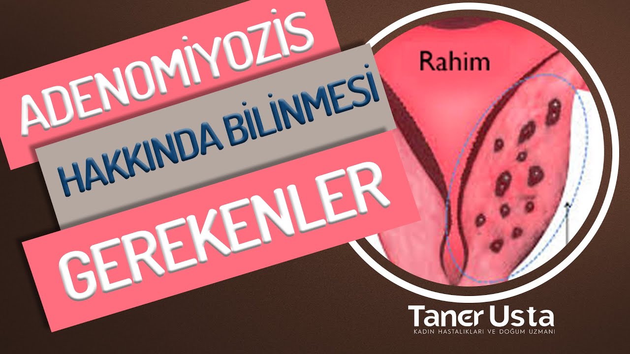 Adenomyozis Nedir? - Prof. Dr. Taner Usta