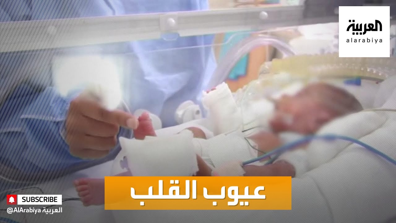 صباح العربية | عيوب القلب الخلقية عند الأطفال