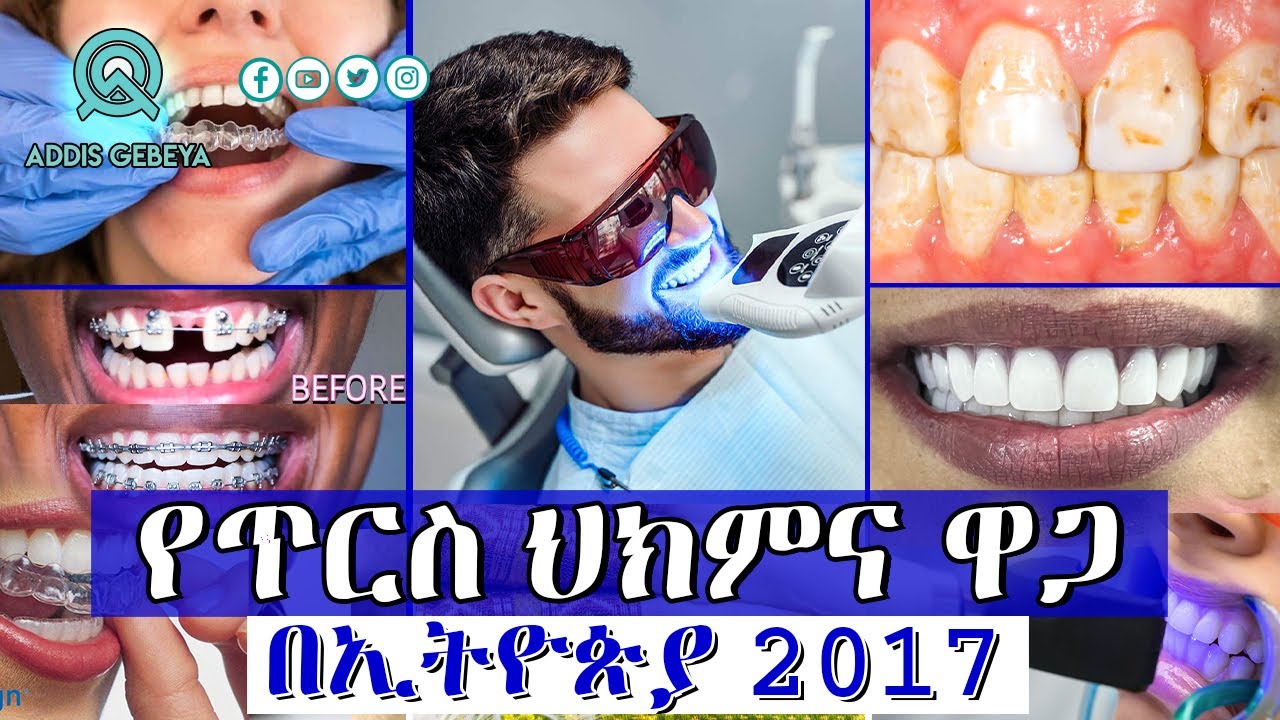 የጥርስ ህክምና ዋጋ በኢትዮጵያ 2017 | ethiopia dental clinic price |