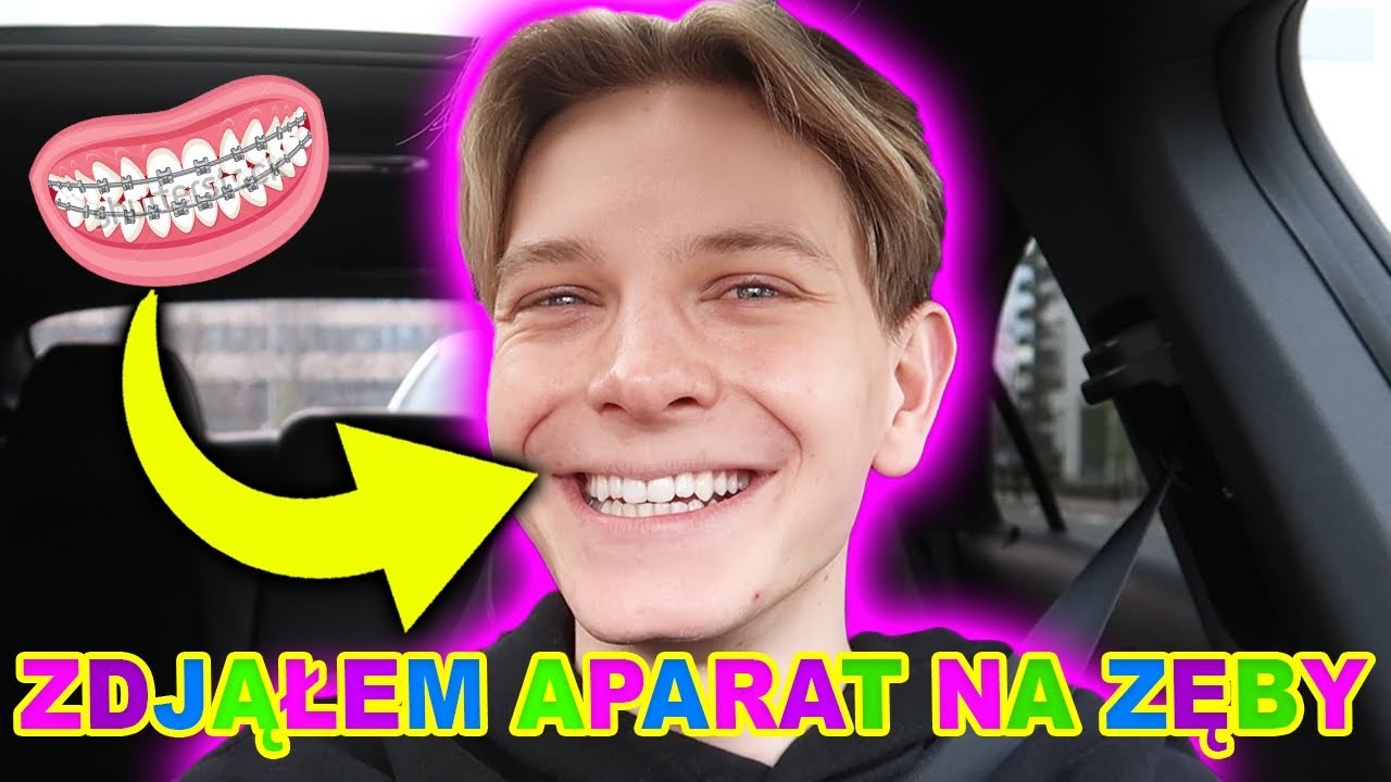 mam proste zęby!!🦷😍