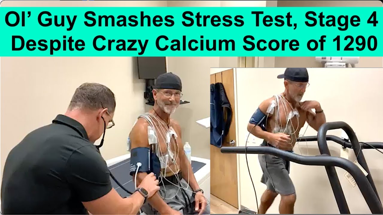 Cardiac Stress Test on Treadmill for Coronary Risk: 53 yo Smashes Stress Test w/ 1290 Calcium Score