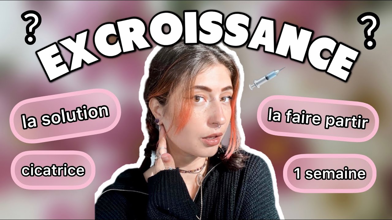 FAIRE PARTIR UNE EXCROISSANCE DE PIERCING : SOLUTION RADICALE 💉