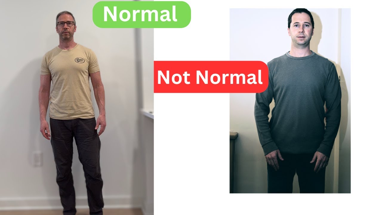 Why do People Stand Like This? (Posture Issues Explained)
