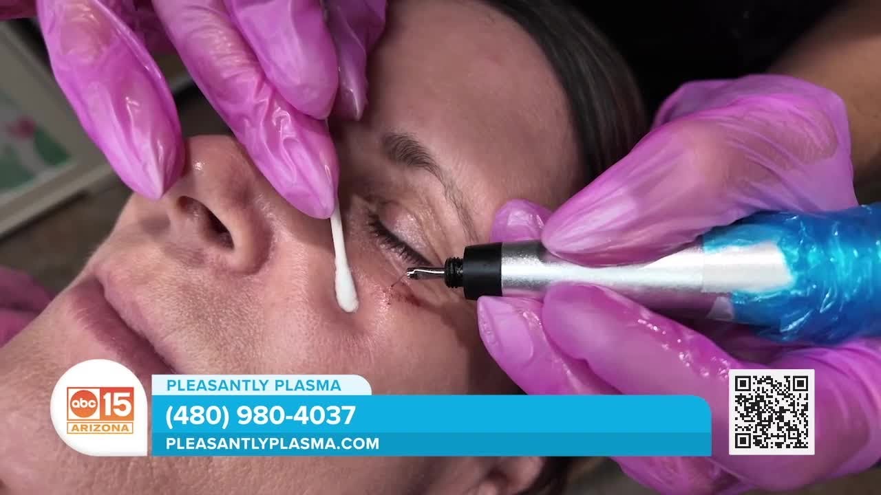 Instantly eliminate wrinkles and smooth skin with the Fibroblast Plasma Pen at Pleasantly Plasma