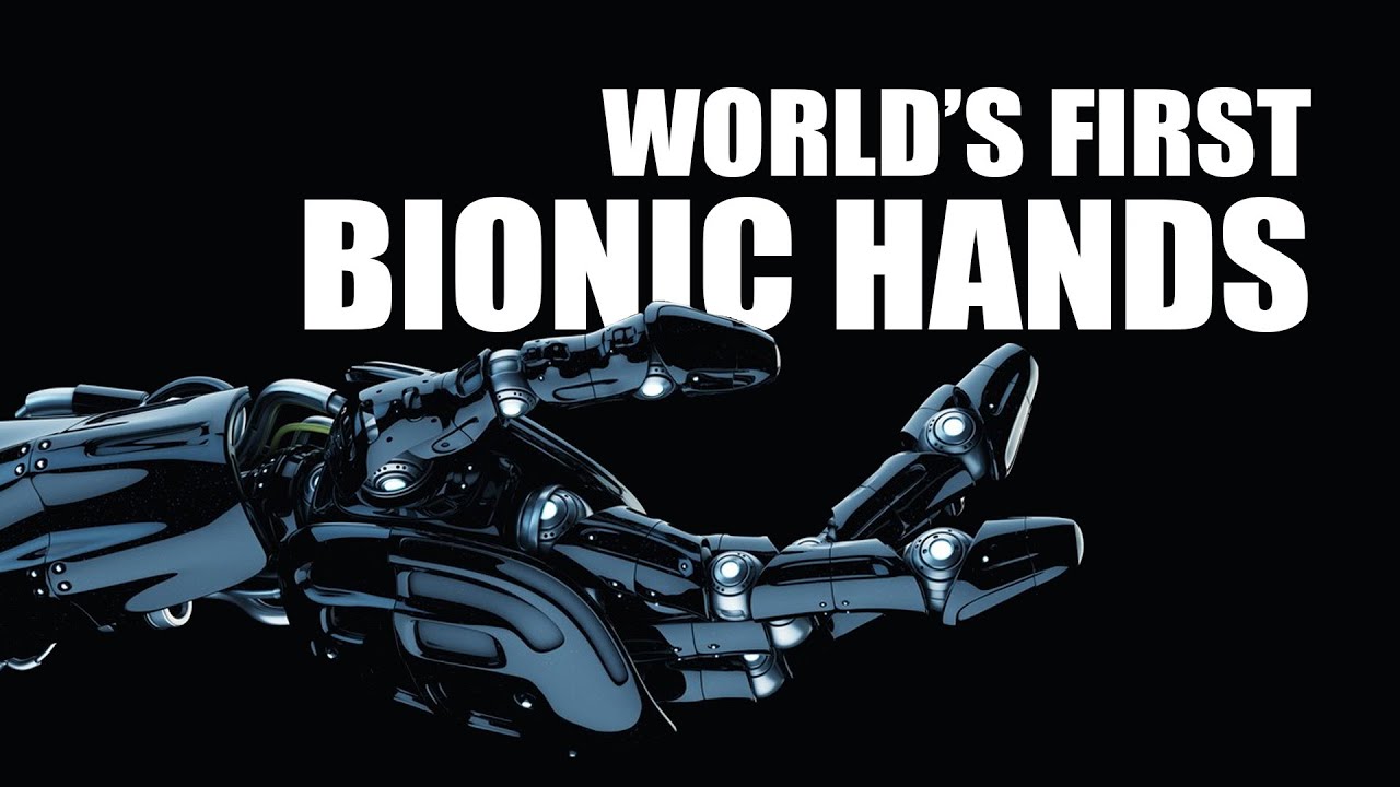 World's First Bionic Hands a Success! - The Know