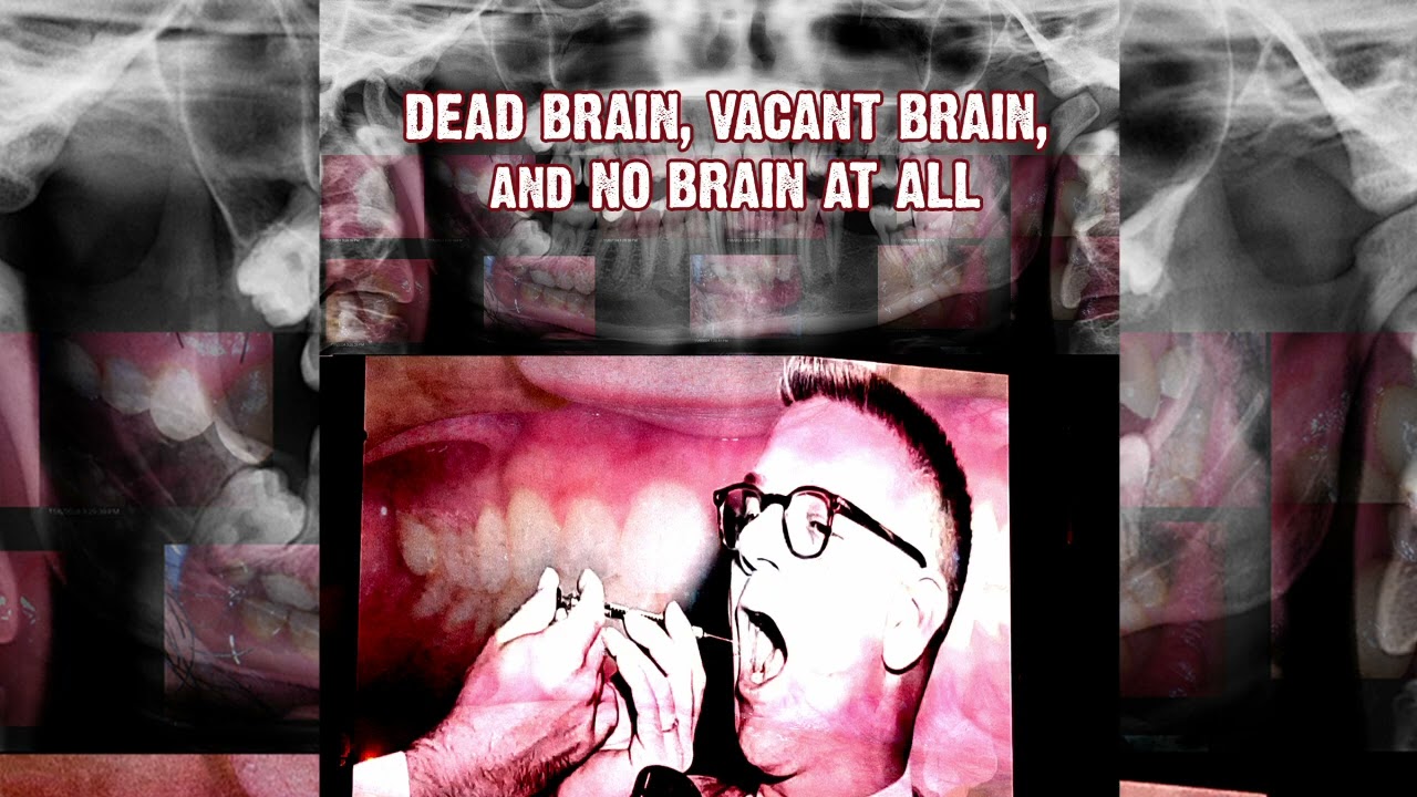 DEADBRAIN, Vacant Brain, and No Brain At All
