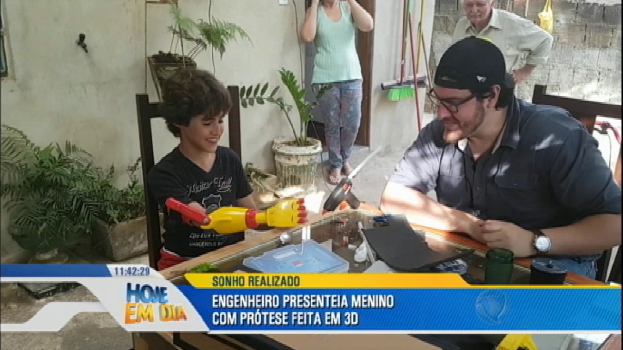 Menino sem braço ganha prótese de engenheiro
