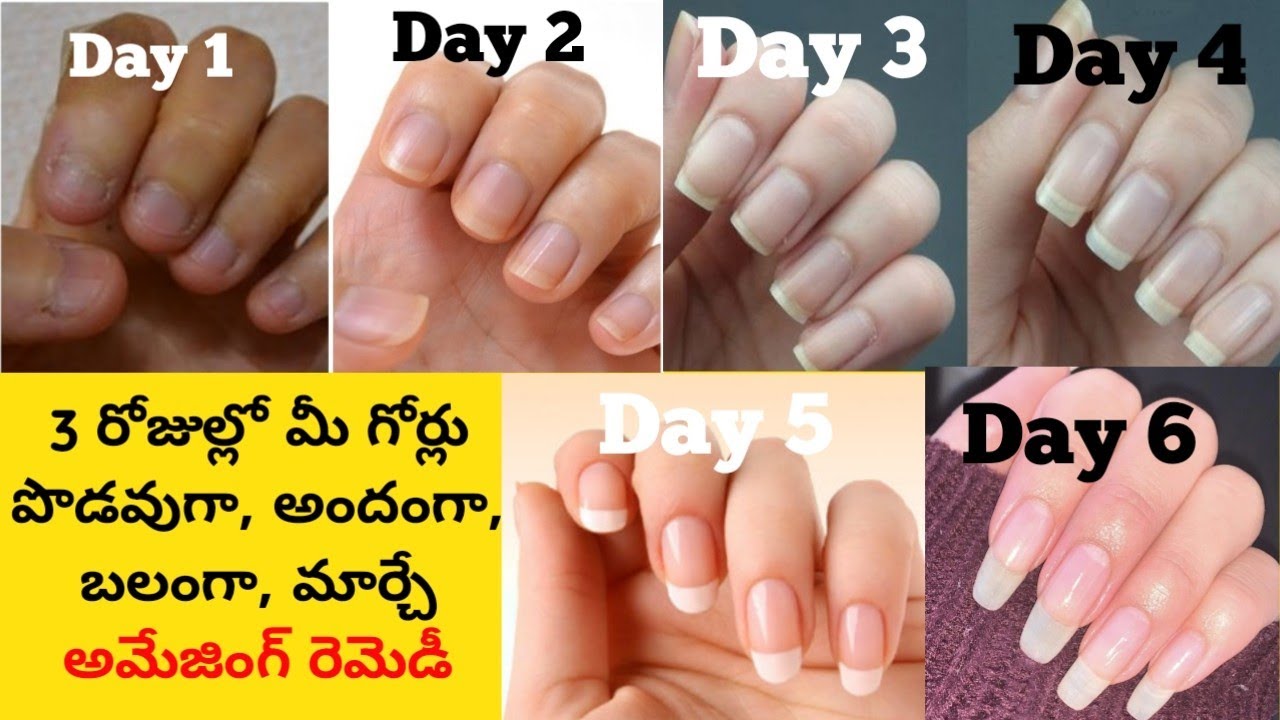 Grow Nails In Just 3 Days || Faster NailGrowth 💅 Tips || How To Grow Nails Faster In One Day || 2021
