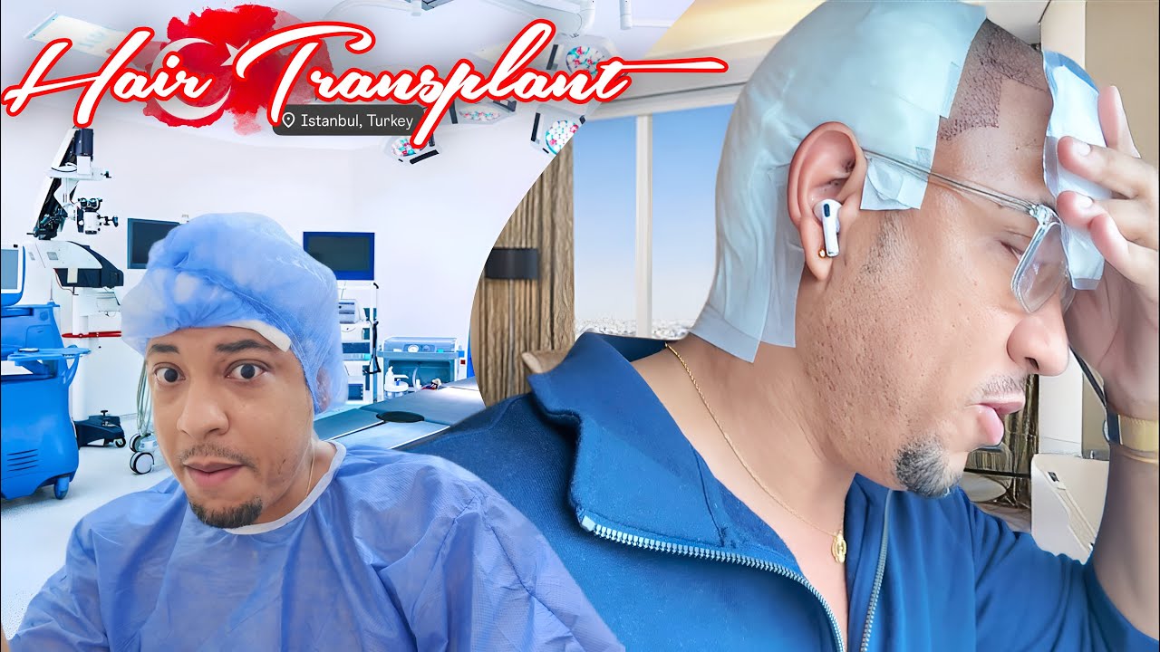 MY HAIR TRANSPLANT SURGERY IN TURKEY | QUITE PERRY