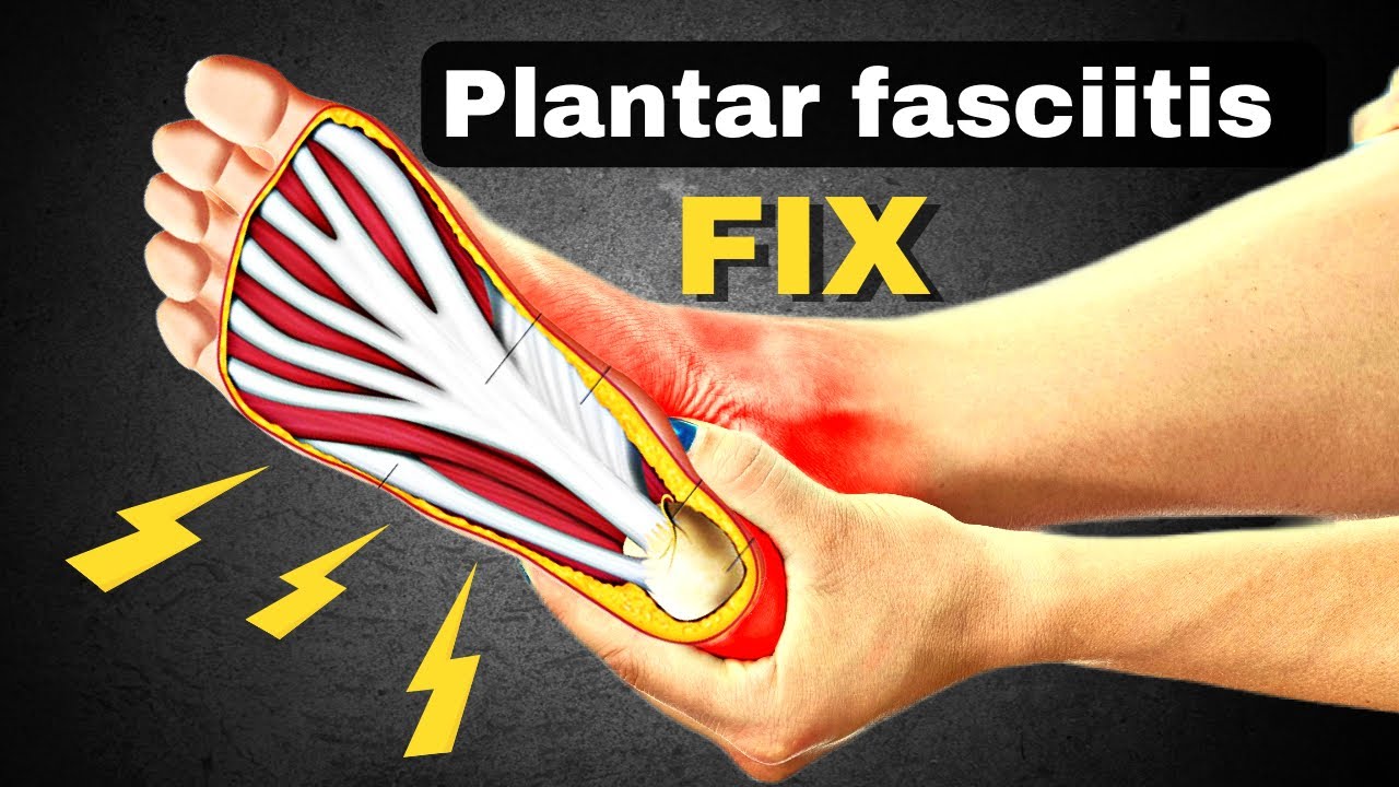The ONLY THING you need if you have plantar fascia pain.