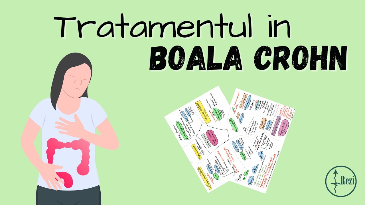 REZIDENTIAT: Tratamentul in BOALA CROHN | Gastro