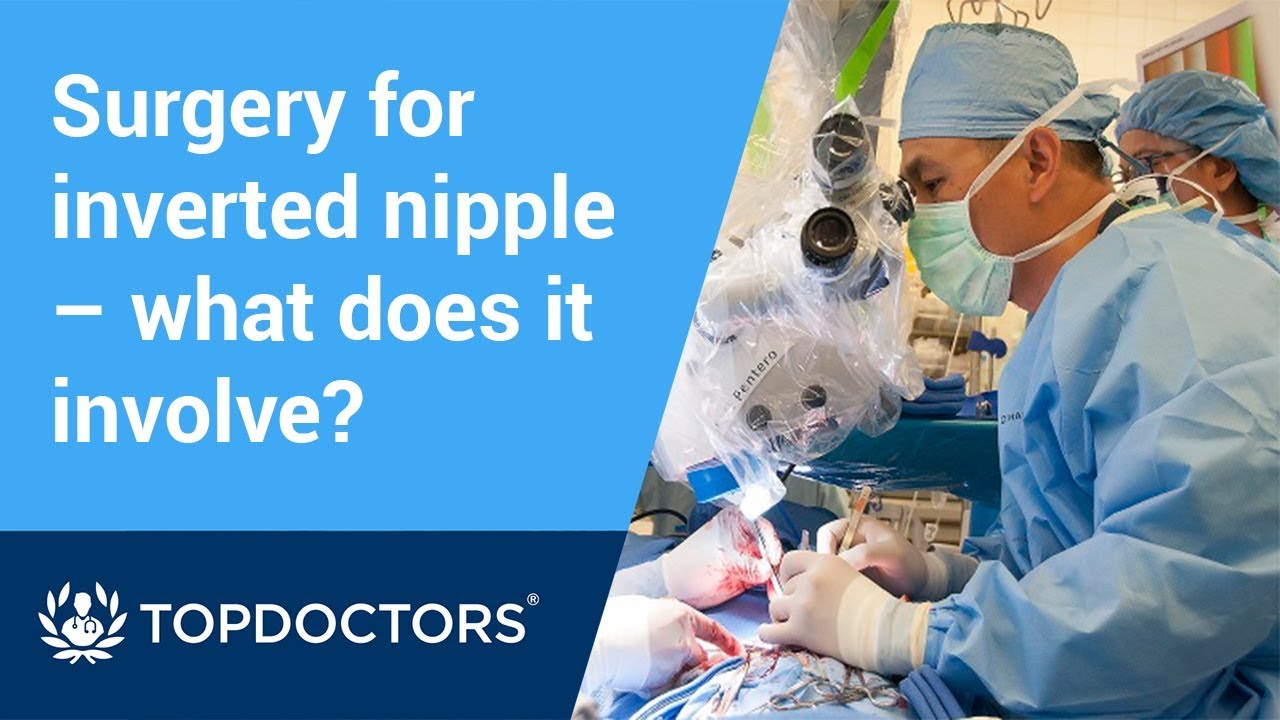 Surgery for inverted nipple &ndash; what does it involve?