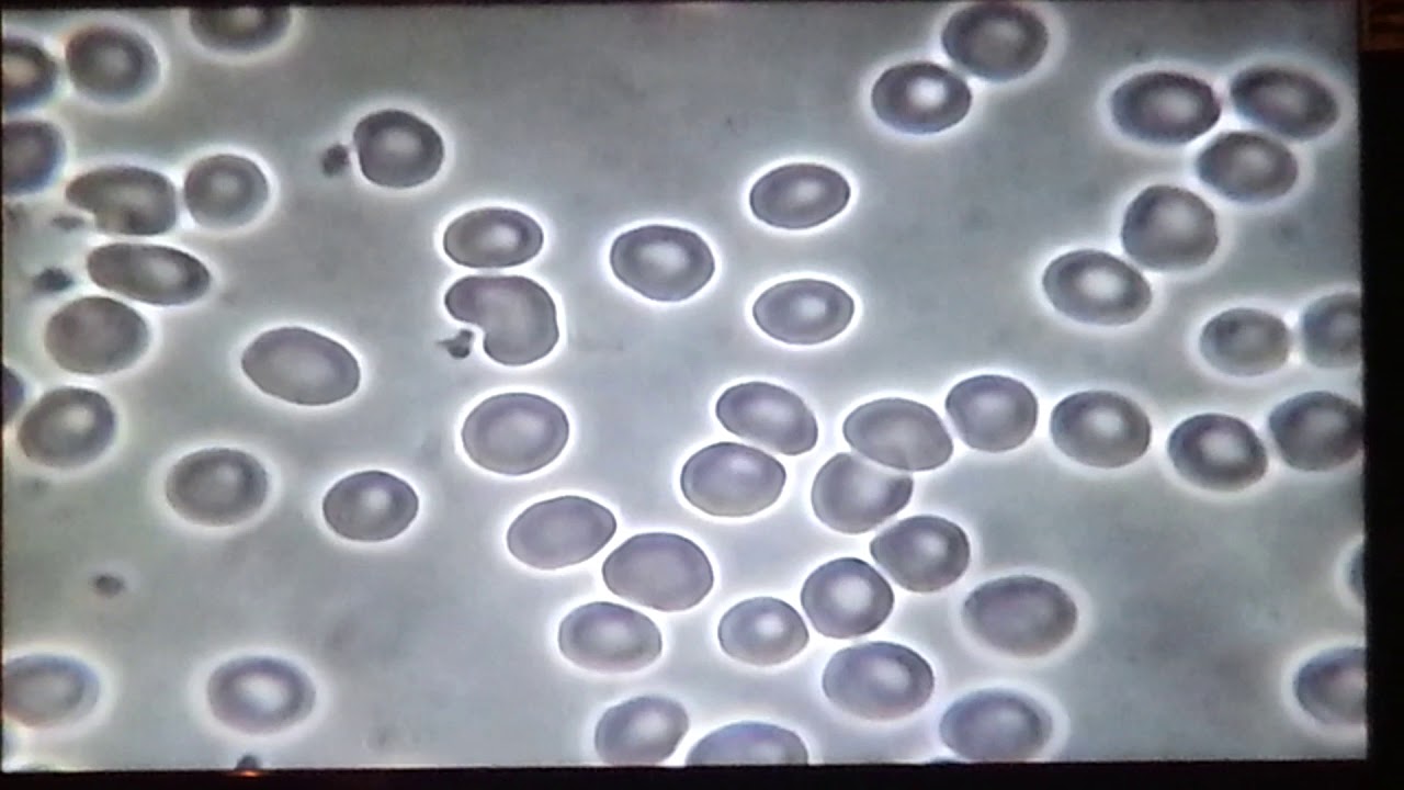 Black Oxygen Organics - Oxygenized Blood after 5 minutes of drinking NuWTR Fulvic Minerals