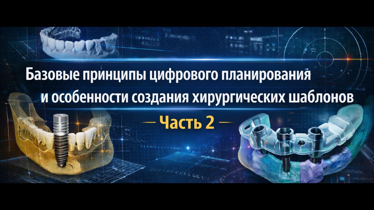 Цифровое планирование имплантации / Basic Principles of Digital Implant Planning  Часть 2