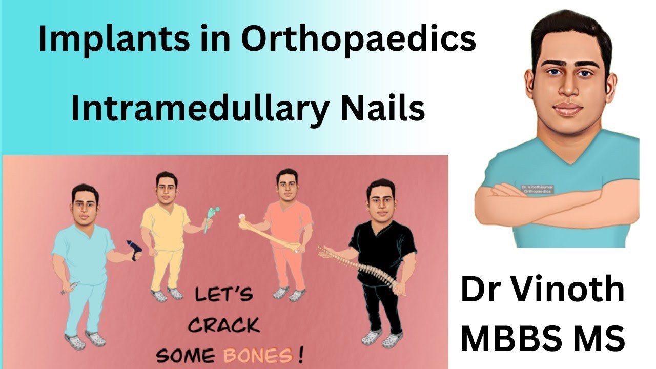 Implants in Orthopaedics| Intramedullary Nails | Femur nail | TENS nail | Tibia nail | NEXT Ortho