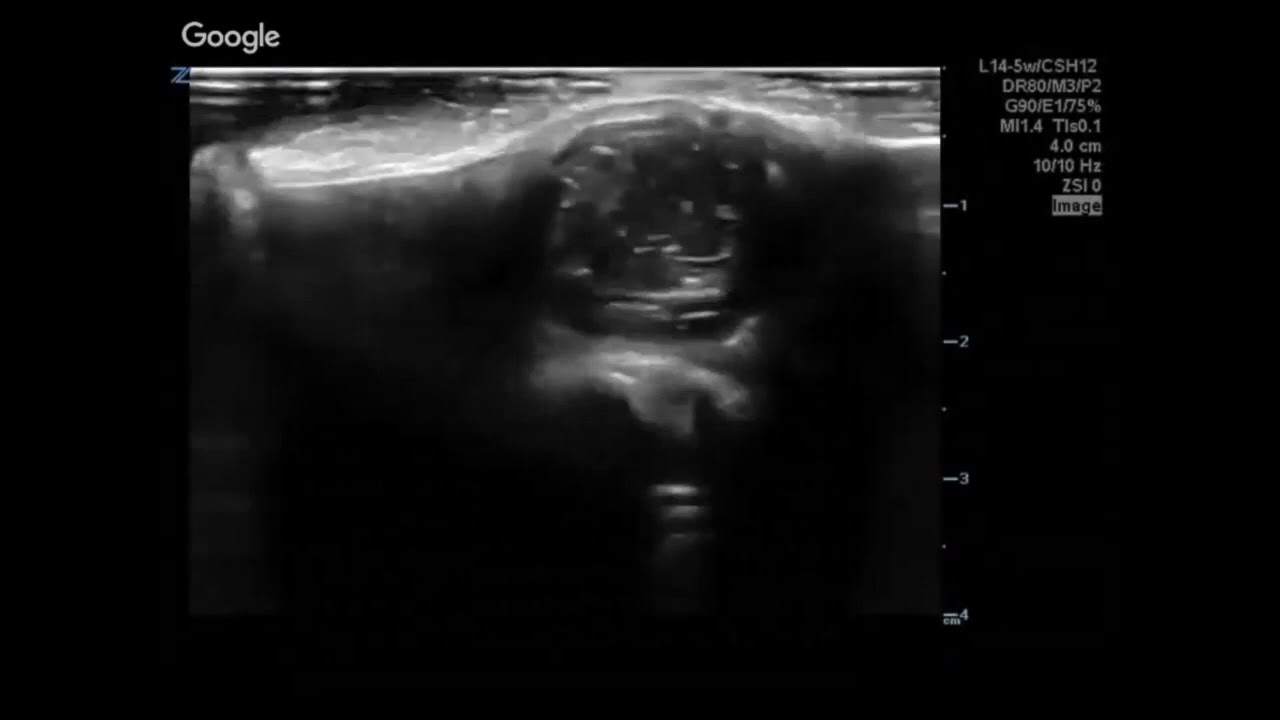 Cysts (3/5)
