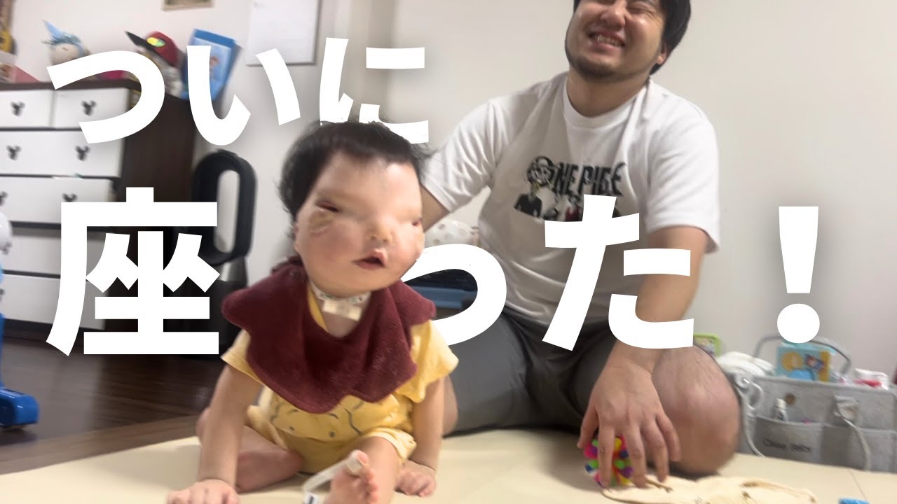 【お座りできた！】リハビリ頑張ったね、おもちくん【1歳7ヶ月】