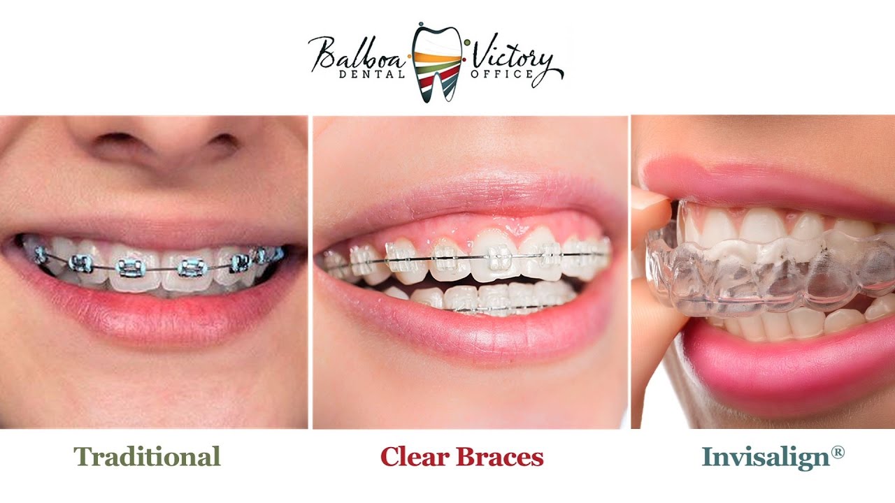 Encino Orthodontist