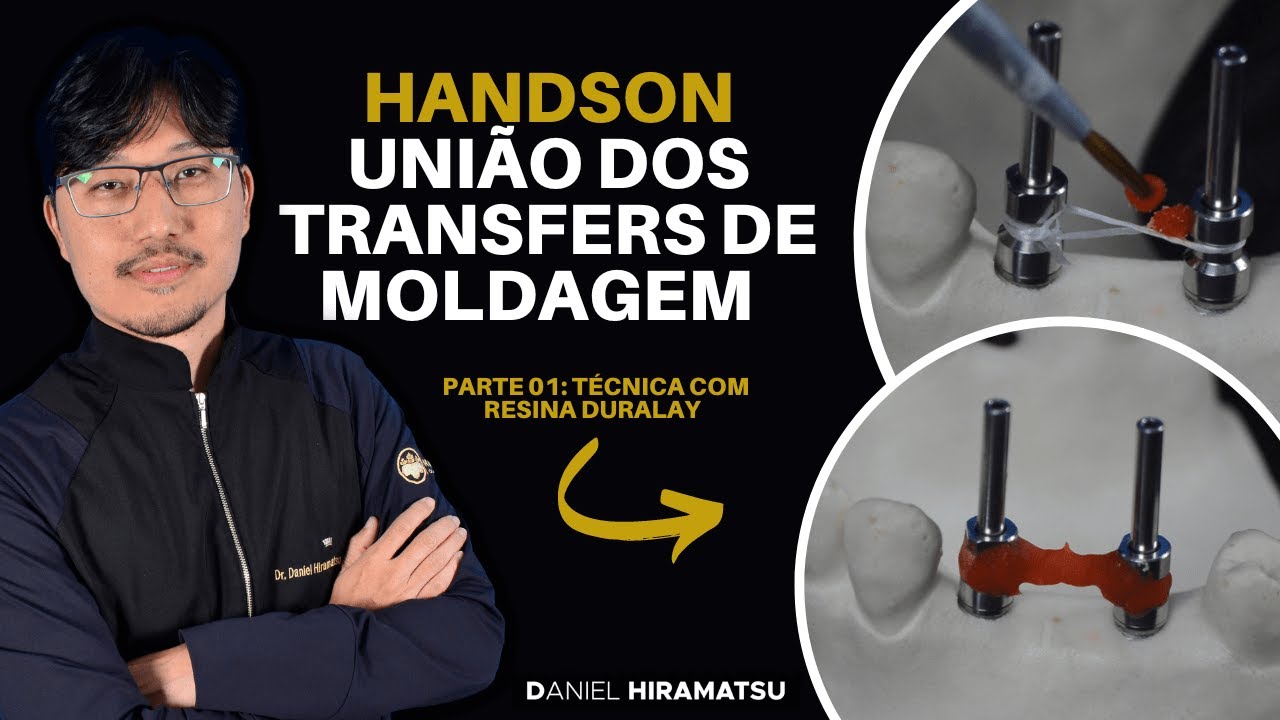 União dos Transfers de Moldagem | Parte 01: Técnica com Resina Duralay - HandsOn