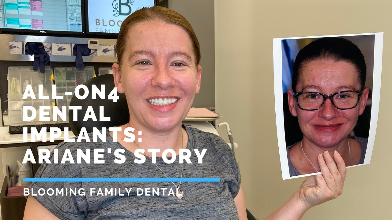 All-On-4 Dental Implants: Ariane's Story
