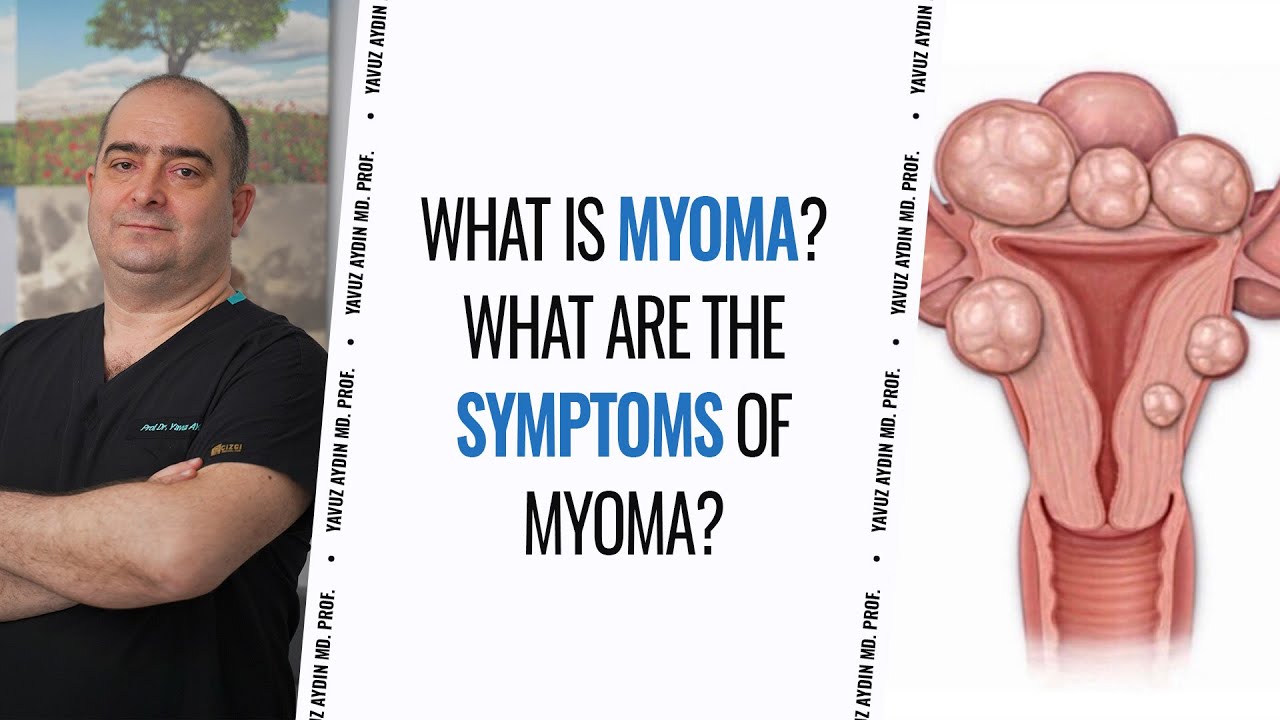 What is myoma? What are the symptoms of myoma?