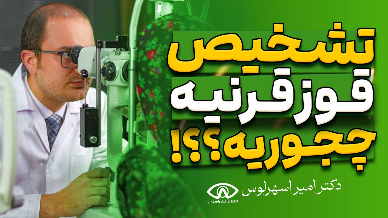 تشخیص قوز قرنیه چجوریه؟؟؟