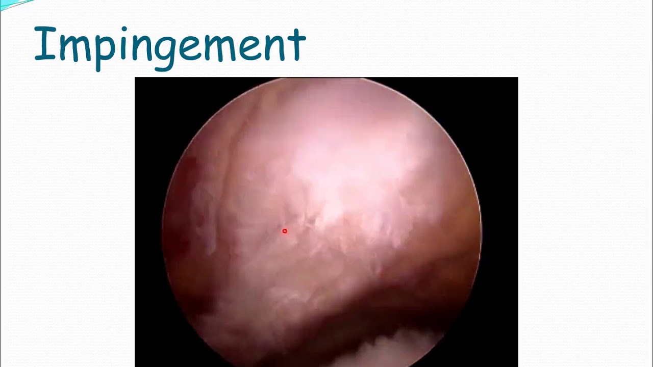 Examination- Shoulder