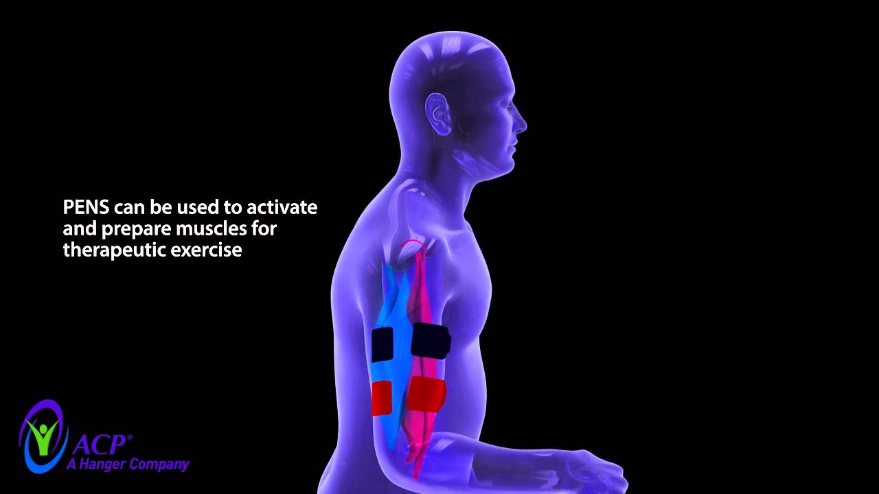 ACP's PENS (Patterned Electrical Neuromuscular Stimulation) Technology