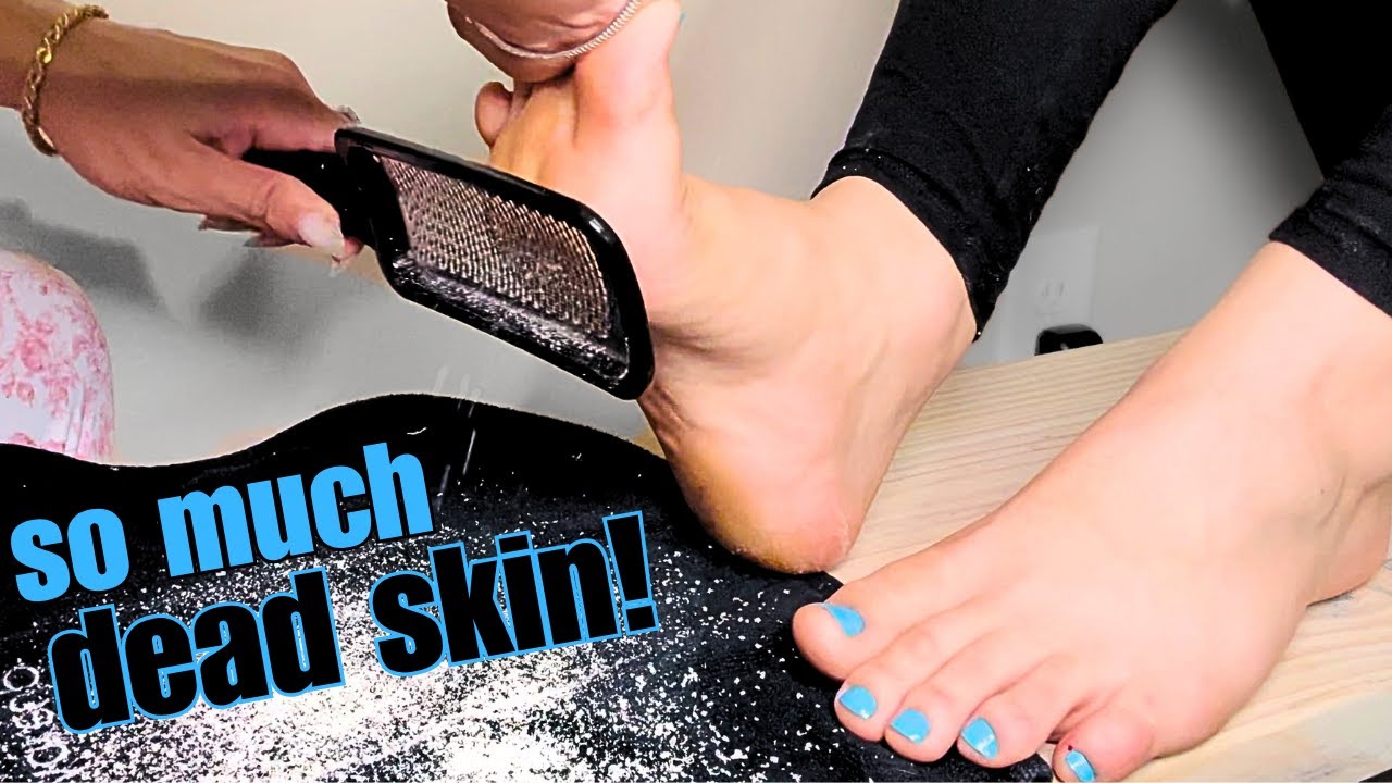 ASMR Dead Skin Removal 😱 INSANE Feet Exfoliation!🦶🏻