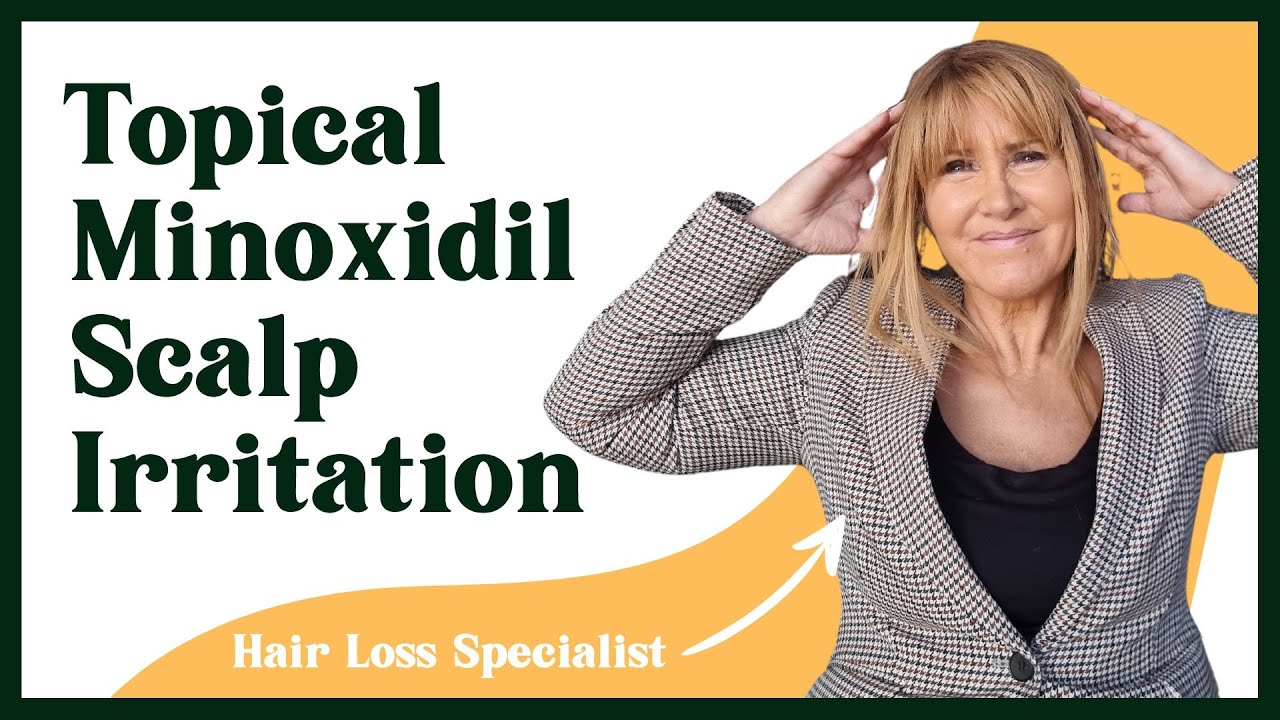 Managing Scalp Irritation with Topical Minoxidil