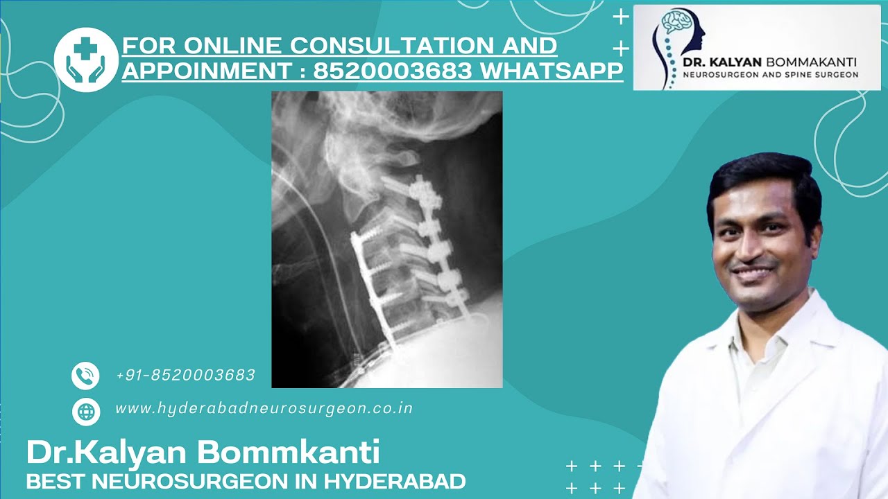 Complicated spine surgeries​Occiput to C2 fixation​