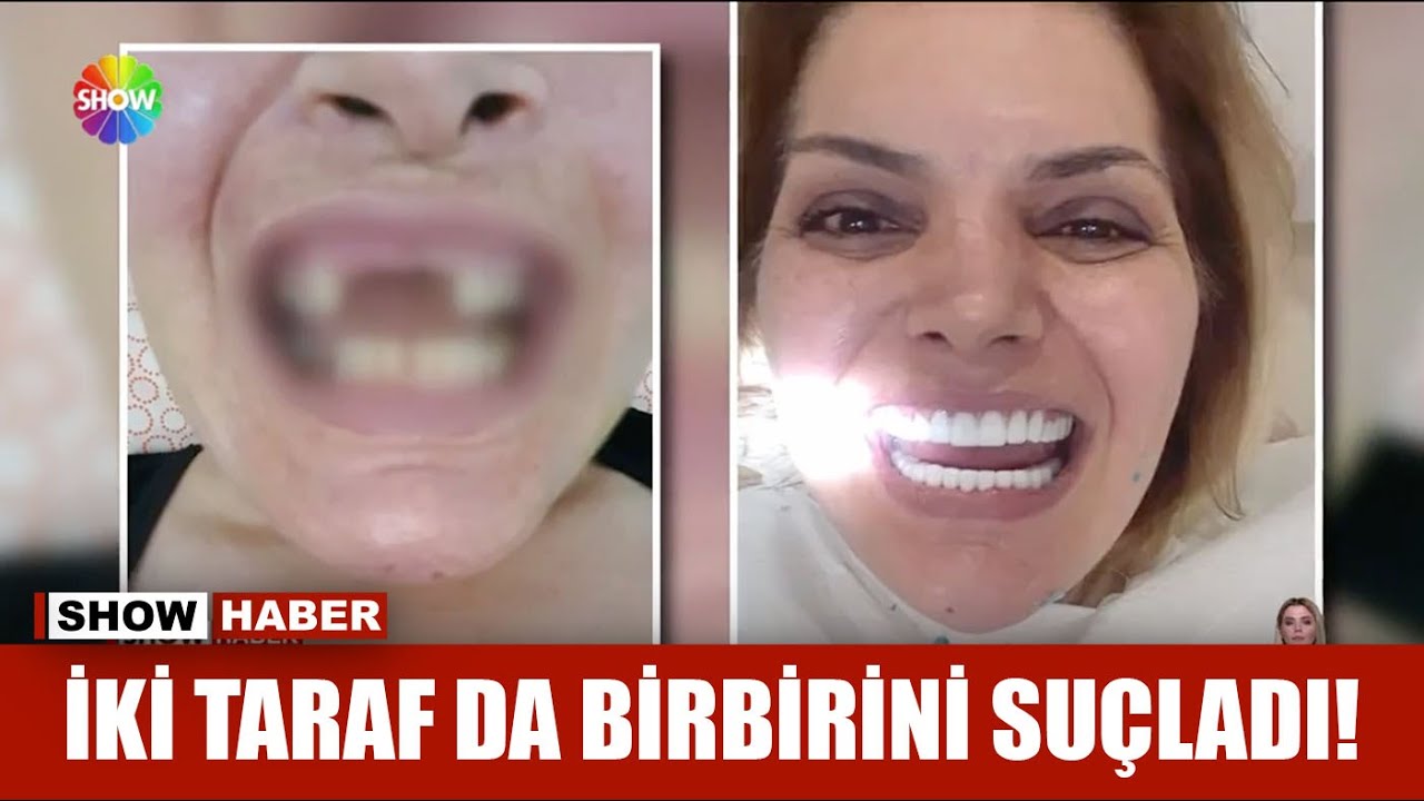 Diş tedavisi için gitti, dert sahibi oldu