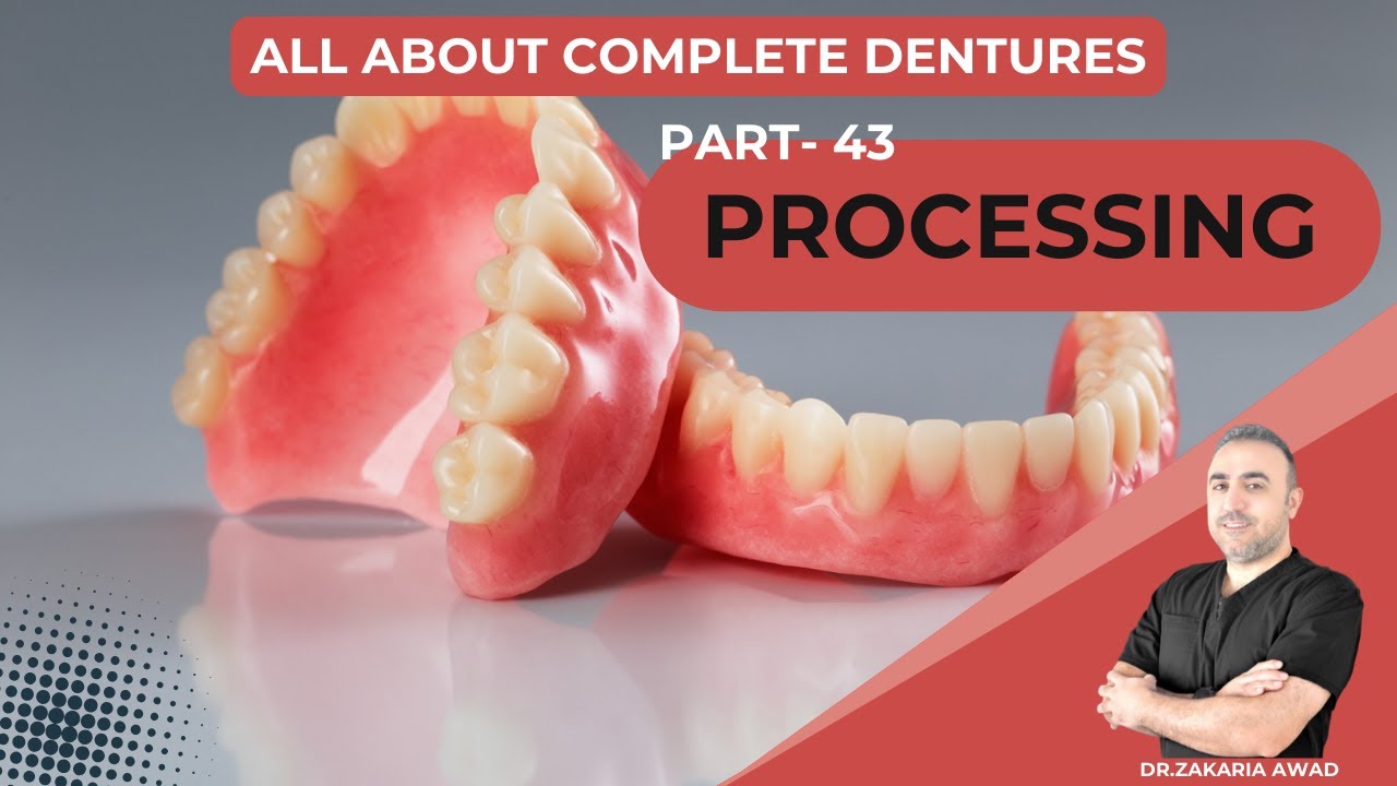 43- Complete Denture Processing: Waxing, Flasking, and Finishing