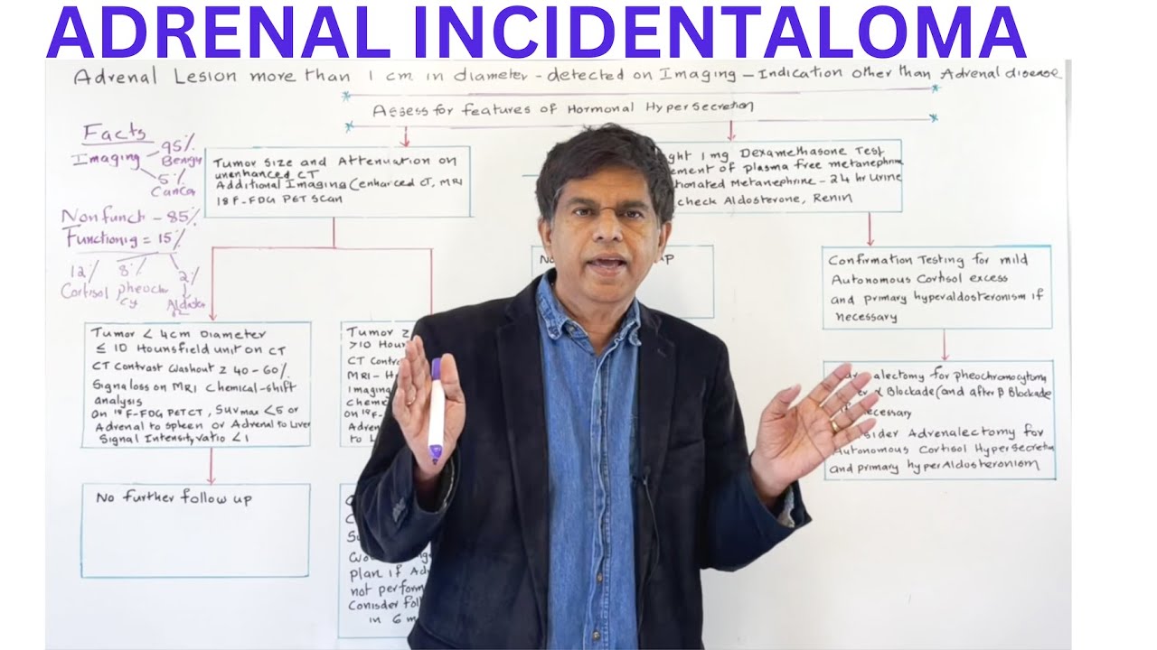 ADRENAL INCIDENTALOMA- By Pramil Cheriyath MD