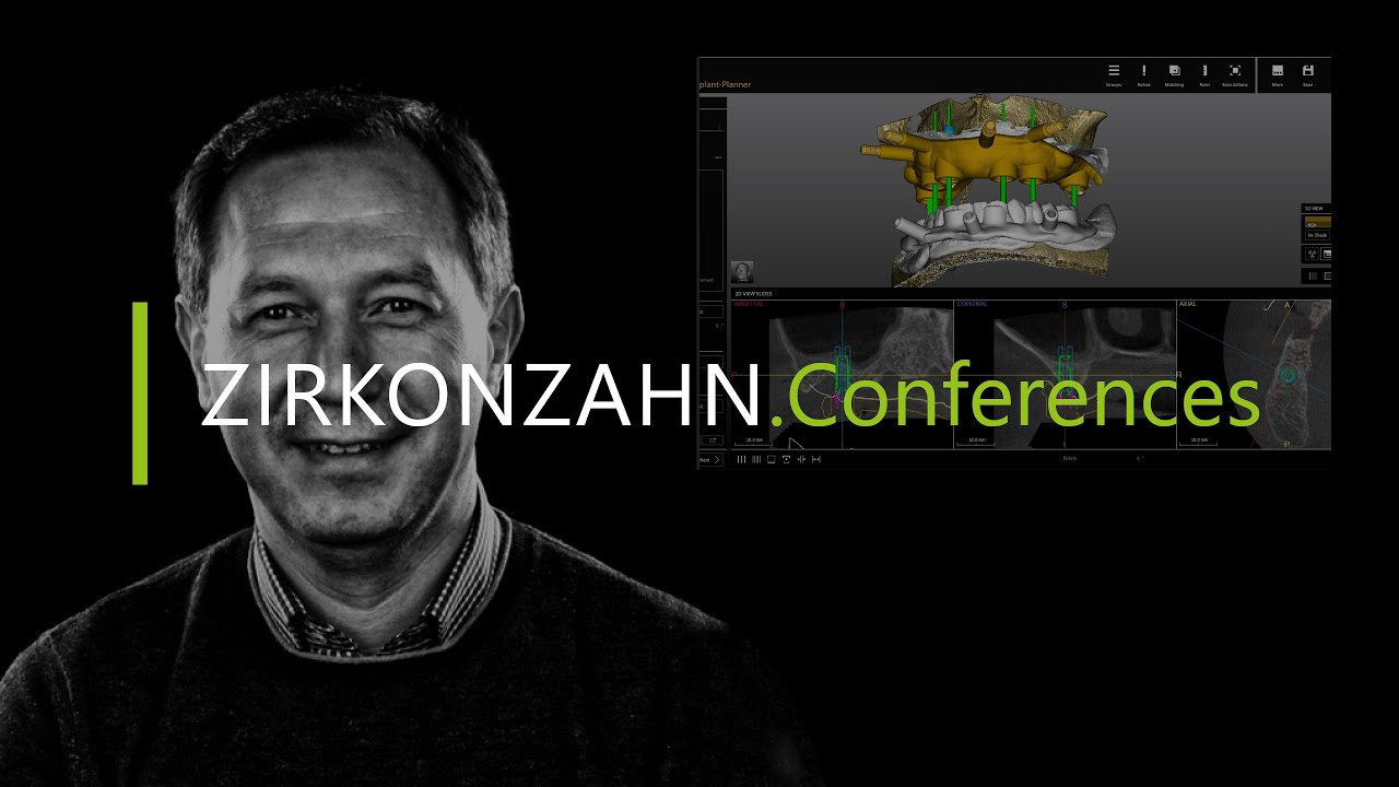 Caso clinico full-digital con matching delle impronte nel carico immediato | Zirkonzahn.Conferences