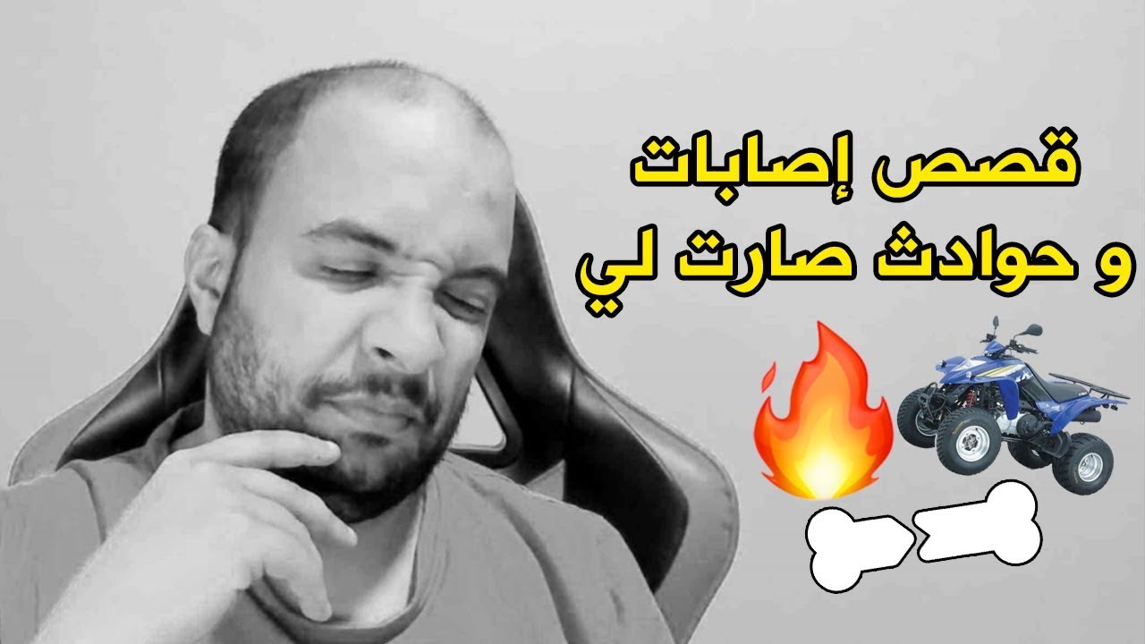 قصص و مواقف إصابات خطيرة صارت لي .. 💔