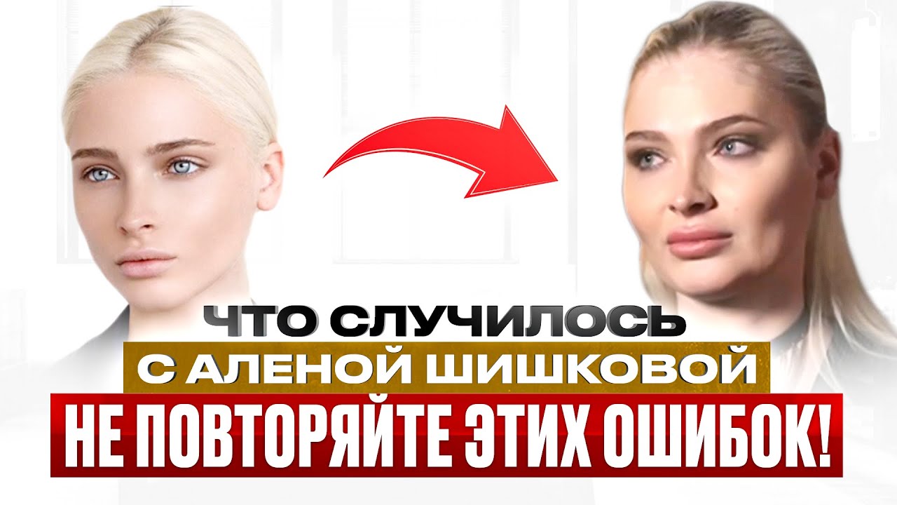 В чём ОПАСНОСТЬ КОСМЕТОЛОГИИ? Разбираем на примере Алёны Шишковой