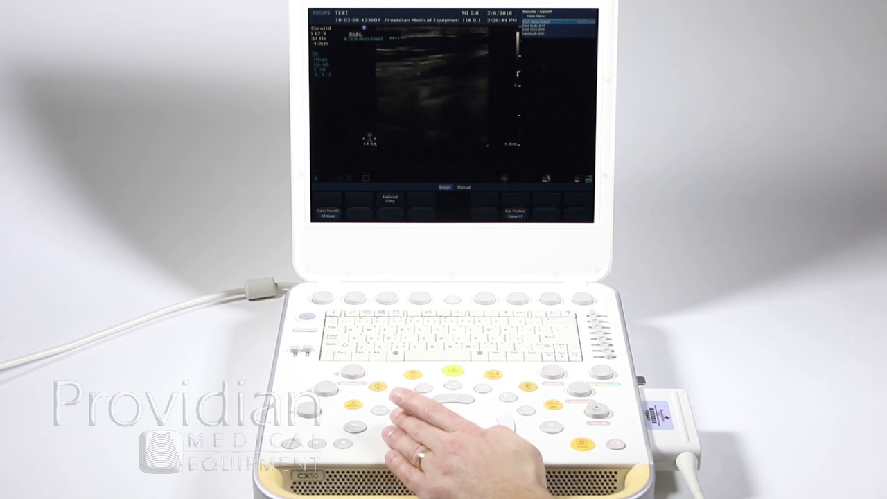 Philips CX50 Training Part 3: Calculations, Measurements, Annotations