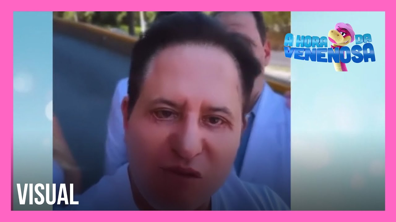 Marrone volta ao hospital para refazer cirurgia plástica