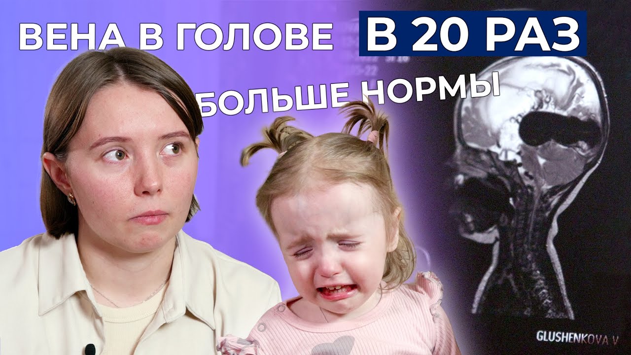 МАЛЬФОРМАЦИЯ ВЕНЫ ГАЛЕНА | История Василисы Глушенковой