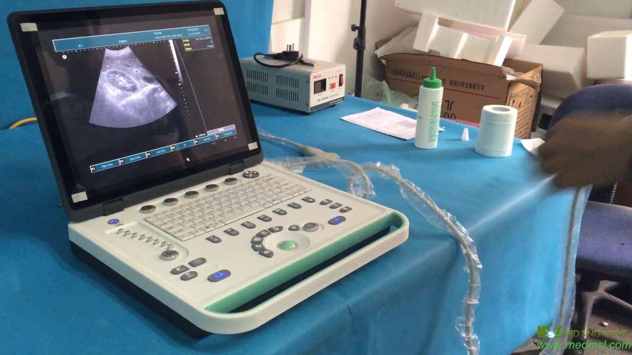 cheap 3d laptop ultrasound machine MSLPU34 video