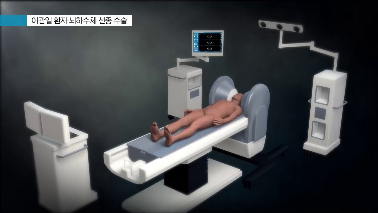 뇌하수체 선종 수술