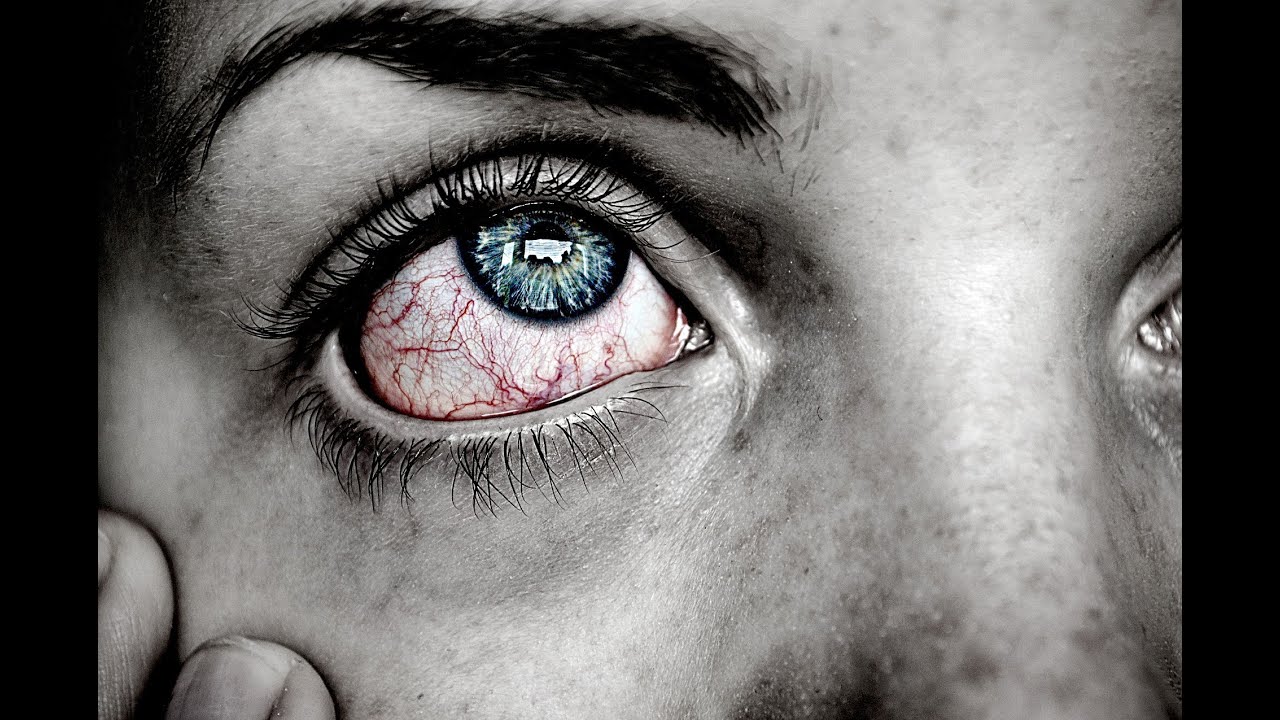 Reiki for eye pain, eye pain and headache