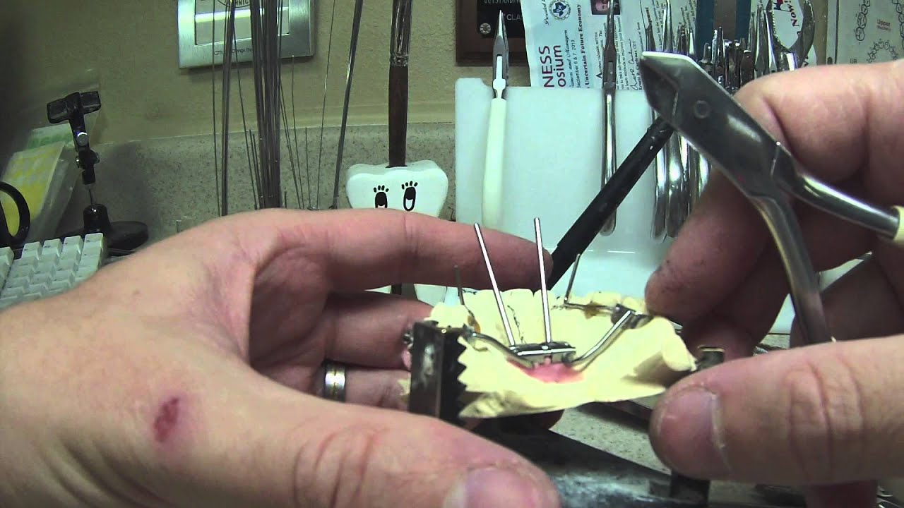 Rapid Palital Expander  - YouTube Version