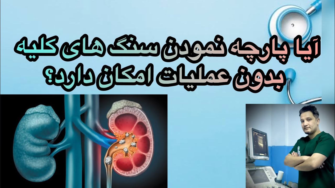 آیا پارچه نمودن سنگ های گرده بدون عملیات امکان دارد؟